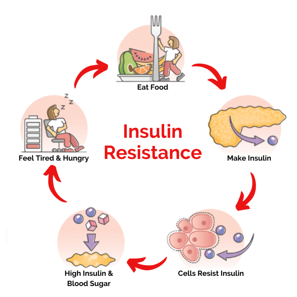 Insulin Resistance