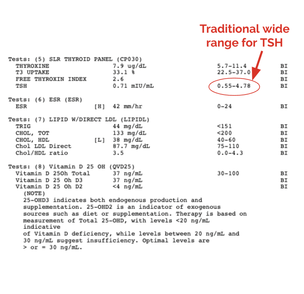 Traditional Wide Range for TSH